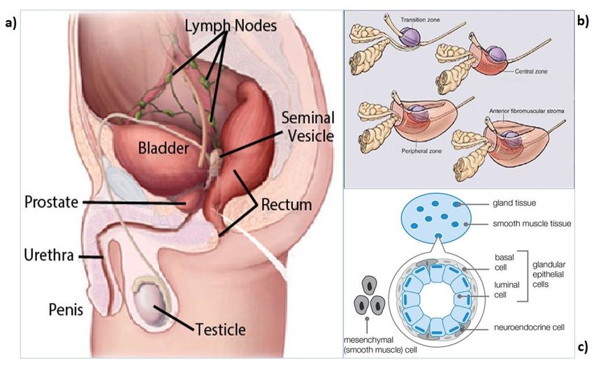 Prostadine Colibrim Exposed: The Surprising Truth About Its Prostate Benefits